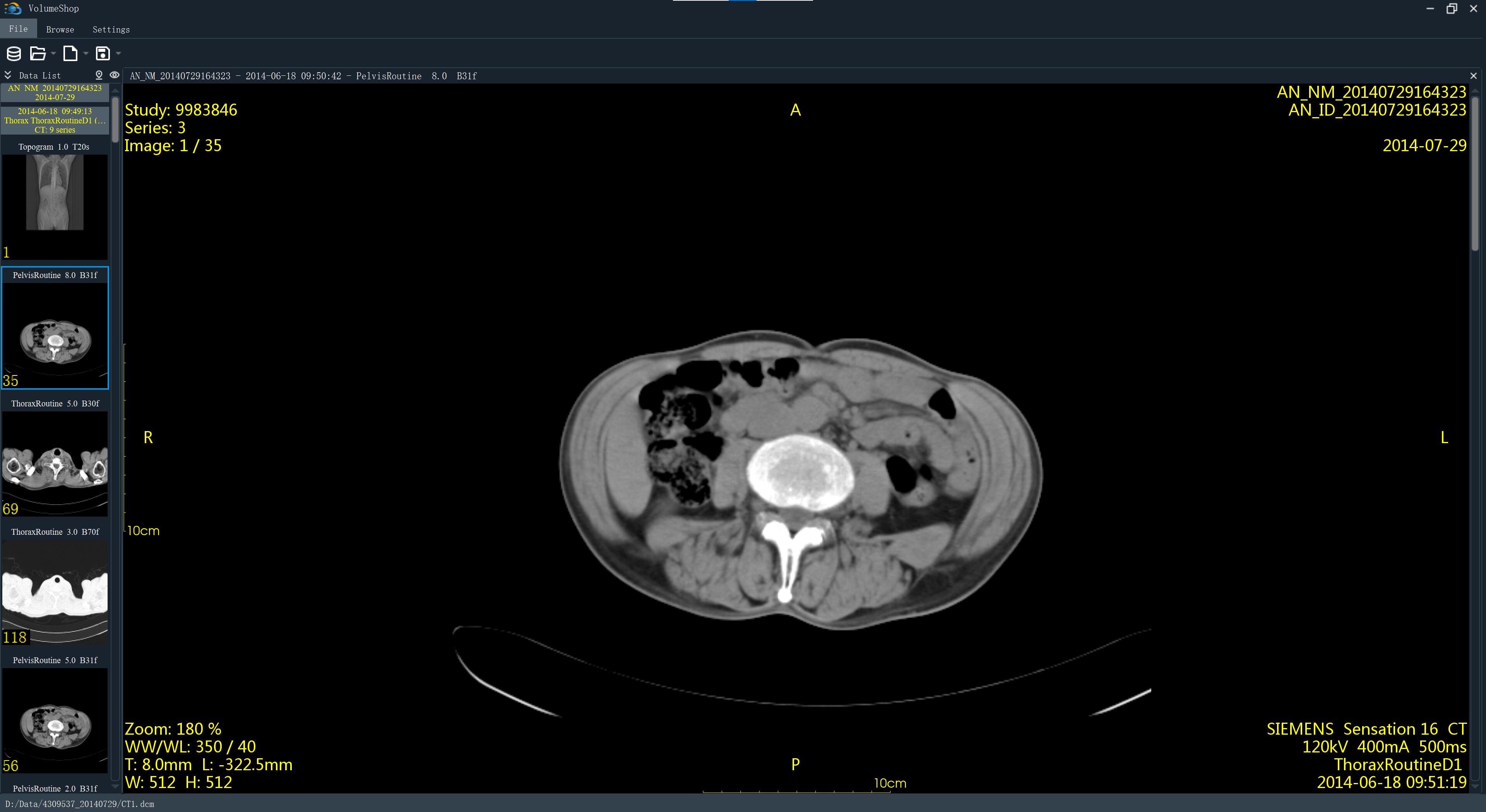 main image description